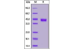 Human CD32b/c, SUMO,His Tag on  under reducing (R) condition.