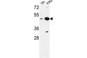 Western Blotting (WB) image for anti-Nucleoporin Like 2 (NUPL2) antibody (ABIN3004233) (NUPL2 Antikörper)