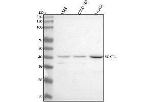 Western blot analysis of SOX18 using anti-SOX18 antibody (ABIN7606358).