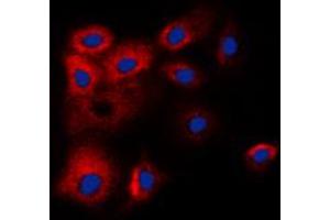 Immunofluorescent analysis of BCLW staining in HL60 cells.