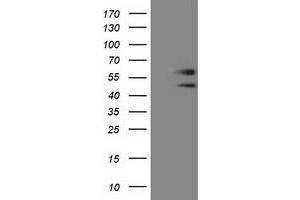 Western Blotting (WB) image for anti-Chromosome 9 Open Reading Frame 41 (C9orf41) antibody (ABIN1497061)