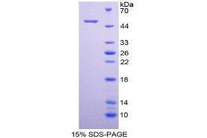 SDS-PAGE (SDS) image for Plakophilin 1 (PKP1) (AA 500-742) protein (His tag,GST tag) (ABIN2123474)