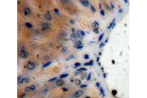 IHC-P analysis of Liver tissue, with DAB staining. (IL1RN Antikörper  (AA 26-177))