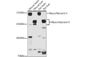 Western blot analysis of extracts of various cell lines, using Neurofilament H antibody (ABIN6129638, ABIN6144512, ABIN6144513 and ABIN6224502) at 1:1000 dilution. (NEFH Antikörper  (AA 821-1020))