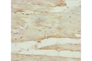 Immunohistochemistry (IHC) image for anti-Guanine Nucleotide Binding Protein (G Protein), alpha 15 (Gq Class) (GNA15) (AA 1-374) antibody (ABIN7154739)