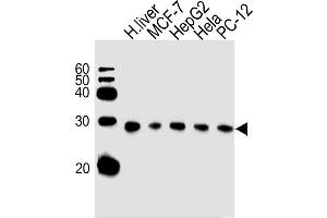 Lane 1: Human Liver Lysates, Lane 2: MCF-7 Cell Lysates, Lane 3: HepG2 Cell Lysates, Lane 4: HeLa Cell Lysates, Lane 5: PC-12 Cell Lysates, probed with PSMA5 (426CT8. (PSMA5 Antikörper)