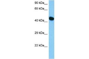 Host:  Mouse  Target Name:  HNF1B  Sample Tissue:  Mouse Skeletal Muscle  Antibody Dilution:  1ug/ml