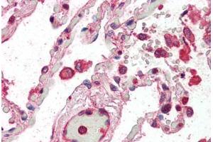 Human Lung (formalin-fixed, paraffin-embedded) stained with CENTB2 antibody ABIN337012 at 5 ug/ml followed by biotinylated anti-goat IgG secondary antibody ABIN481715, alkaline phosphatase-streptavidin and chromogen. (Centaurin beta 2 Antikörper  (AA 766-778))