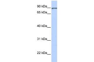 WB Suggested Anti-L3MBTL Antibody Titration:  0. (L3MBTL1 Antikörper  (N-Term))