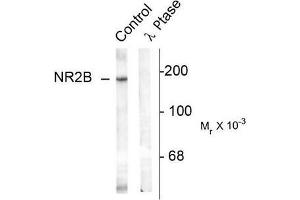Image no. 1 for anti-Glutamate Receptor, Ionotropic, N-Methyl D-Aspartate 2B (GRIN2B) (pTyr1336) antibody (ABIN372686) (GRIN2B Antikörper  (pTyr1336))