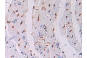 Immunohistochemistry (IHC) image for anti-Oncostatin M (OSM) (AA 116-205) antibody (ABIN7438130)