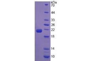 SDS-PAGE of Protein Standard from the Kit (Highly purified E. (Calreticulin ELISA Kit)