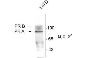 Western Blotting (WB) image for anti-Progesterone Receptor (PGR) (pSer190) antibody (ABIN371834) (Progesterone Receptor Antikörper  (pSer190))
