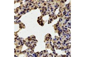 Immunohistochemistry (IHC) image for anti-Ran GTPase Activating Protein 1 (RANGAP1) antibody (ABIN7308258) (RANGAP1 Antikörper)