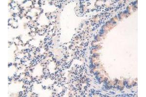 IHC-P analysis of Mouse Lung Tissue, with DAB staining. (WARS Antikörper  (AA 29-195))