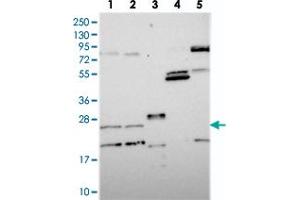 Western blot analysis of Lane 1: RT-4, Lane 2: U-251 MG, Lane 3: Human Plasma, Lane 4: Liver, Lane 5: Tonsil with NUDT16L1 polyclonal antibody  at 1:250-1:500 dilution.