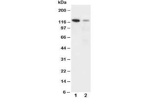 Western blot testing of Integrin alpha 3 antibody and Lane 1:  rat heart;  2: HeLa cell lysate. (ITGA3 Antikörper  (N-Term))