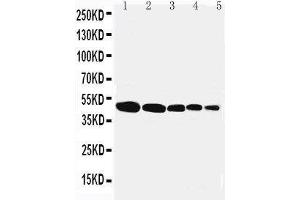 Anti-Flotillin 1 antibody, Western blotting Lane 1: Rat Lung Tissue Lysate Lane 2: Rat Brain Tissue Lysate Lane 3: Rat Ovary Tissue Lysate Lane 4: SMMC Cell Lysate Lane 5: MFC-7 Cell Lysate (Flotillin 1 Antikörper  (Middle Region))