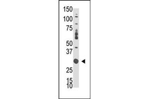 Western Blotting (WB) image for anti-Docking Protein 5 (DOK5) (C-Term) antibody (ABIN359963)