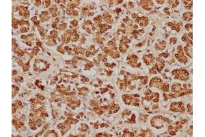 Immunohistochemistry (IHC) image for anti-Histone H2B Type 2-E (HIST2H2BE) (AA 2-126) antibody (ABIN7155415)