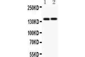 Anti-Collagen III Picoband antibody,  All lanes: Anti Collagen III at 0.