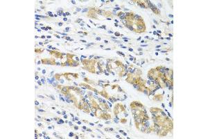 Immunohistochemistry of paraffin-embedded human stomach using IL11 antibody (ABIN5975342) at dilution of 1/100 (40x lens). (IL-11 Antikörper)