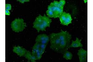 Immunofluorescence staining of MCF-7 cells with ABIN7175232 at 1:50, counter-stained with DAPI. (ATP6V1C1 Antikörper  (AA 129-382))