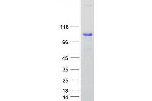 Western Blotting (WB) image for rho Guanine Nucleotide Exchange Factor (GEF) 7 (ARHGEF7) (Transcript Variant 5) protein (Myc-DYKDDDDK Tag) (ABIN2714895)