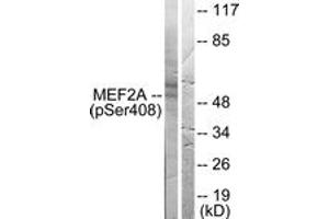 Western blot analysis of extracts from HeLa cells treated with PMA 125ng/ml 30', using MEF2A (Phospho-Ser408) Antibody. (MEF2A Antikörper  (pSer408))