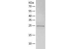 Western Blotting (WB) image for Adenylate Kinase 2 (AK2) (AA 1-239) protein (His tag) (ABIN7121719) (Adenylate Kinase 2 Protein (AK2) (AA 1-239) (His tag))