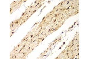 Immunohistochemistry of paraffin-embedded Human colon using CDX1 Polyclonal Antibody at dilution of 1:100 (40x lens). (CDX1 Antikörper)