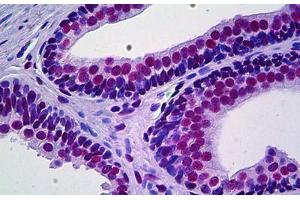 Human Prostate: Formalin-Fixed, Paraffin-Embedded (FFPE) (PRKDC Antikörper  (AA 4019-4129))