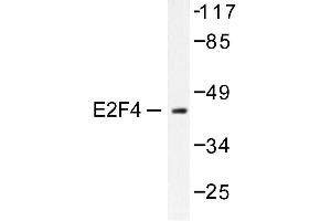 Image no. 1 for anti-E2F4/E2F5 (E2F4/5) antibody (ABIN265389) (E2F4/E2F5 (E2F4/5) Antikörper)
