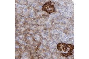 Immunohistochemical staining of human pancreas with LHFPL1 polyclonal antibody  shows strong cytoplasmic positivity in islet cells at 1:50-1:200 dilution. (LHFPL1 Antikörper)