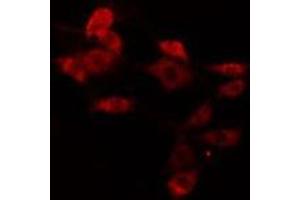 ABIN6275775 staining Hela cells by IF/ICC. (IFIT5 Antikörper  (Internal Region))