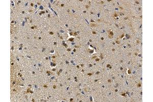 ABIN7095226 and ABIN7099283 at 1/100 staining rat brain tissue by IHC-P.