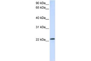 WB Suggested Anti-RAB18 Antibody Titration:  0. (RAB18 Antikörper  (C-Term))
