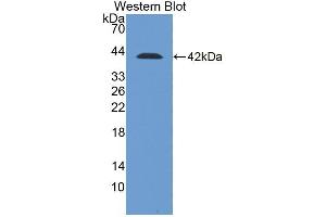 Detection of Recombinant DSC2, Human using Polyclonal Antibody to Desmocollin 2 (DSC2) (Desmocollin 2 Antikörper  (AA 136-471))