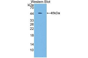Western blot analysis of the recombinant protein. (SCARA5 Antikörper  (AA 118-495))