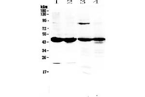 Western blot analysis of ADA using anti-ADA antibody . (ADA Antikörper  (AA 2-241))