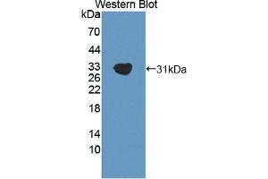 Western blot analysis of the recombinant protein. (GAB2 Antikörper  (AA 357-607))