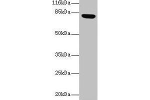 Western blot All lanes: Lhcgr antibody at 2 μg/mL + Rat gonadal tissue Secondary Goat polyclonal to rabbit IgG at 1/10000 dilution Predicted band size: 79, 35, 38, 73, 28, 33, 21, 72, 31, 34, 41 kDa Observed band size: 79 kDa (LHCGR Antikörper  (AA 27-362))