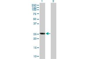 Western Blot analysis of GSTO2 expression in transfected 293T cell line by GSTO2 MaxPab polyclonal antibody.