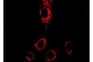 Immunofluorescent analysis of p43 staining in HepG2 cells. (p43 Antikörper)