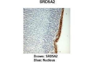 Sample Type :  Monkey adrenal gland   Primary Antibody Dilution :   1:25   Secondary Antibody:  Anti-rabbit-HRP   Secondary Antibody Dilution:   1:1000   Color/Signal Descriptions:  Brown: SRD5A2 Blue: Nucleus   Gene Name:  SRD5A2   Submitted by:  Jonathan Bertin, Endoceutics Inc. (SRD5A2 Antikörper  (N-Term))
