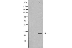 Western blot analysis of CD69 expression in Jurkat cell lysate,The lane on the left is treated with the antigen-specific peptide. (CD69 Antikörper  (Internal Region))