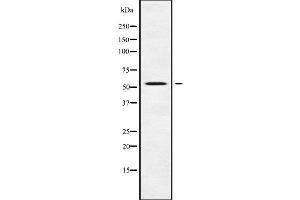 DFNA5 Antikörper  (C-Term)