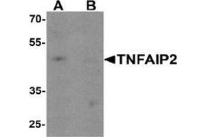 Western blot analysis of TNFAIP2 in K562 cell lysate with TNFAIP2 Antibody  at 1 ug/ml in (A) the absence and (B) the presence of blocking peptide. (TNFAIP2 Antikörper  (Middle Region))