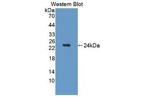 Western Blotting (WB) image for anti-Cerebral Dopamine Neurotrophic Factor (CDNF) (AA 20-183) antibody (ABIN1176537) (CDNF Antikörper  (AA 20-183))