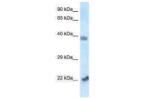 Western Blotting (WB) image for anti-Vacuolar Protein Sorting 72 Homolog (S. Cerevisiae) (VPS72) (N-Term) antibody (ABIN927439)